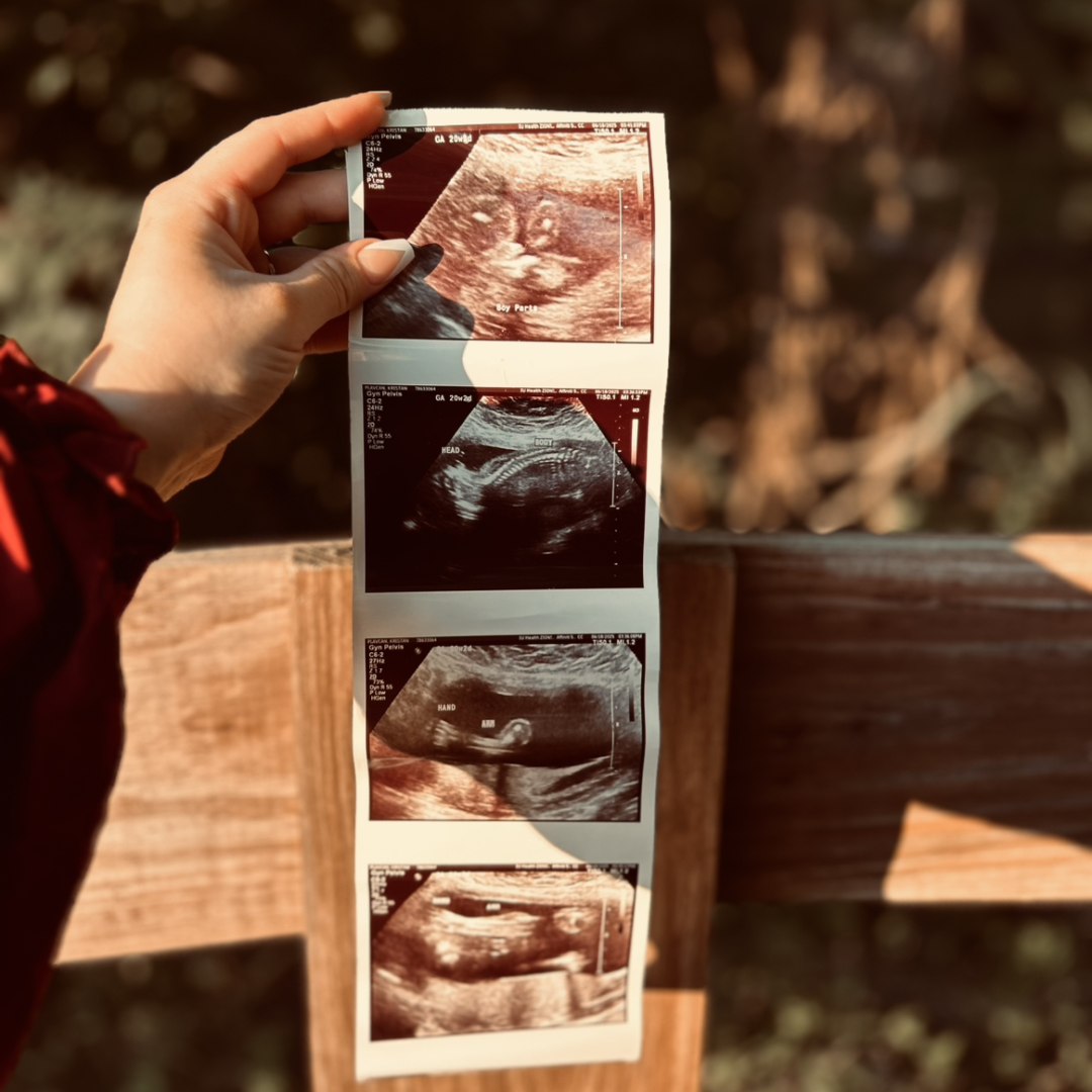 Photo shared by Kristan for their Babylist baby registry.