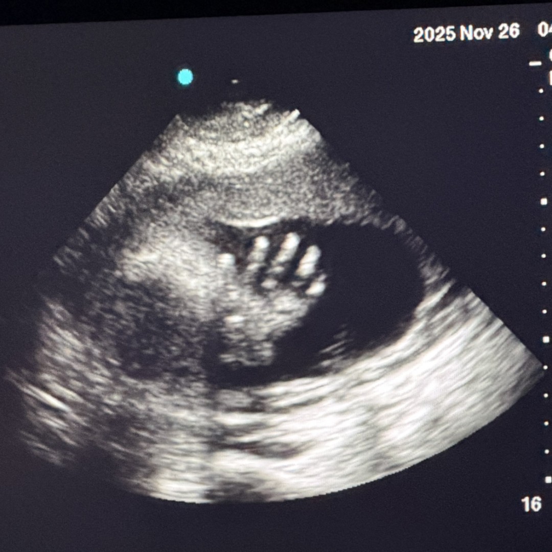 Photo shared by Mackenzie for their Babylist baby registry.