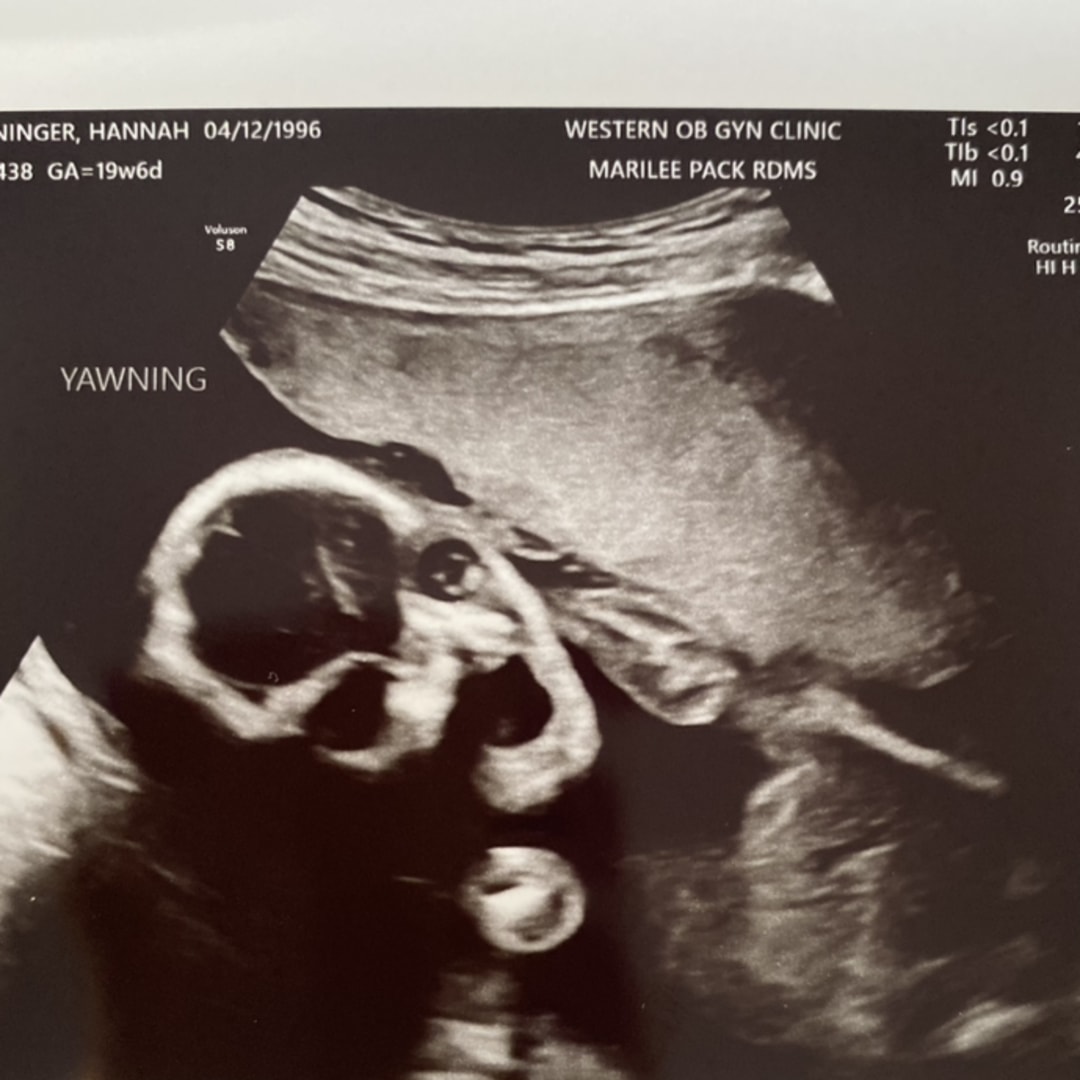 Photo shared by Hannah for their Babylist baby registry.