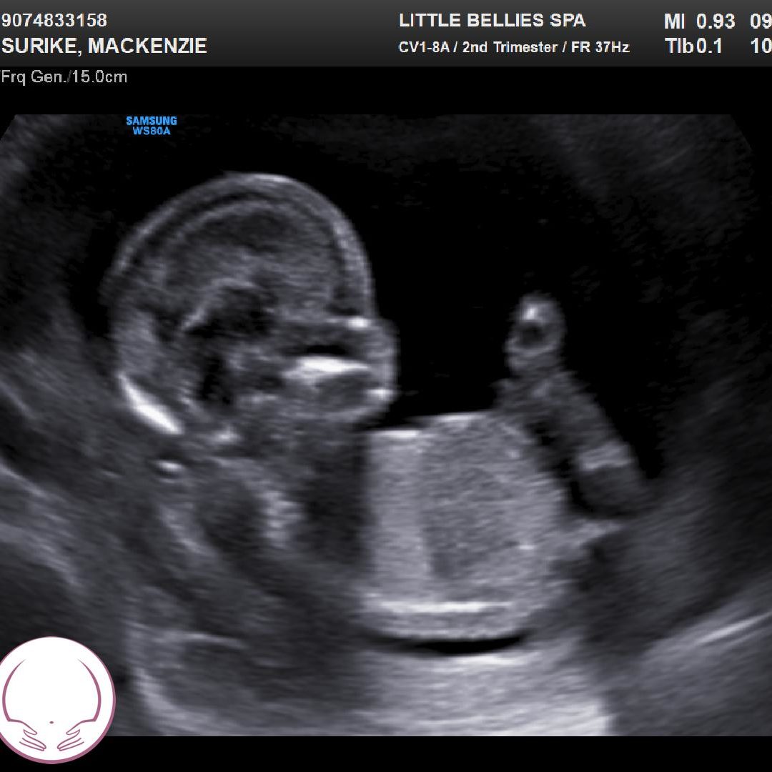 Photo shared by Mackenzie for their Babylist baby registry.
