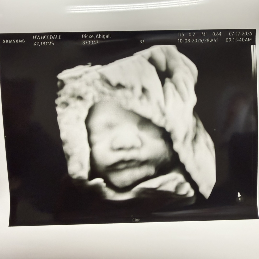 Photo shared by Abby for their Babylist baby registry.