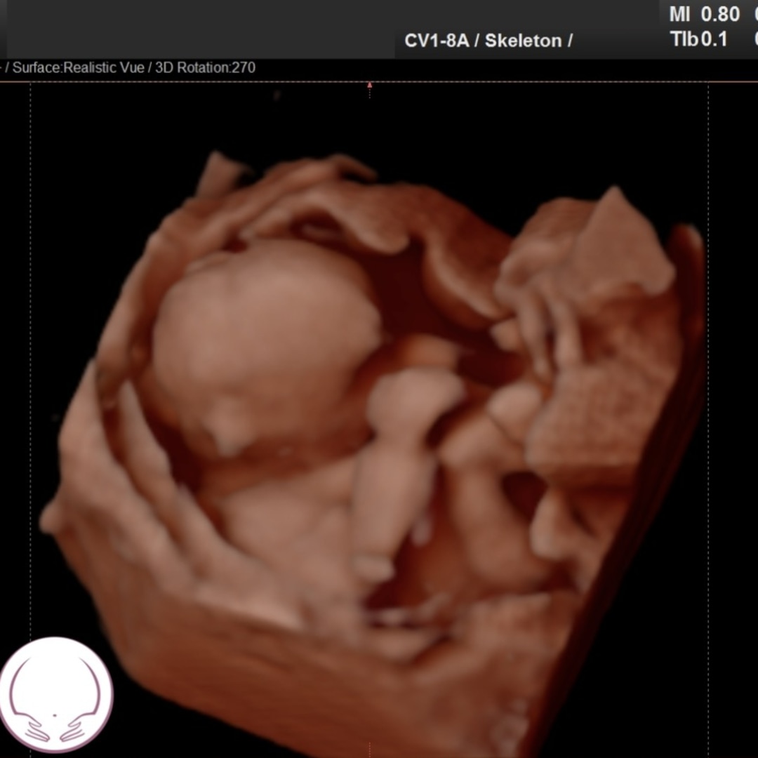 Photo shared by Alison for their Babylist baby registry.