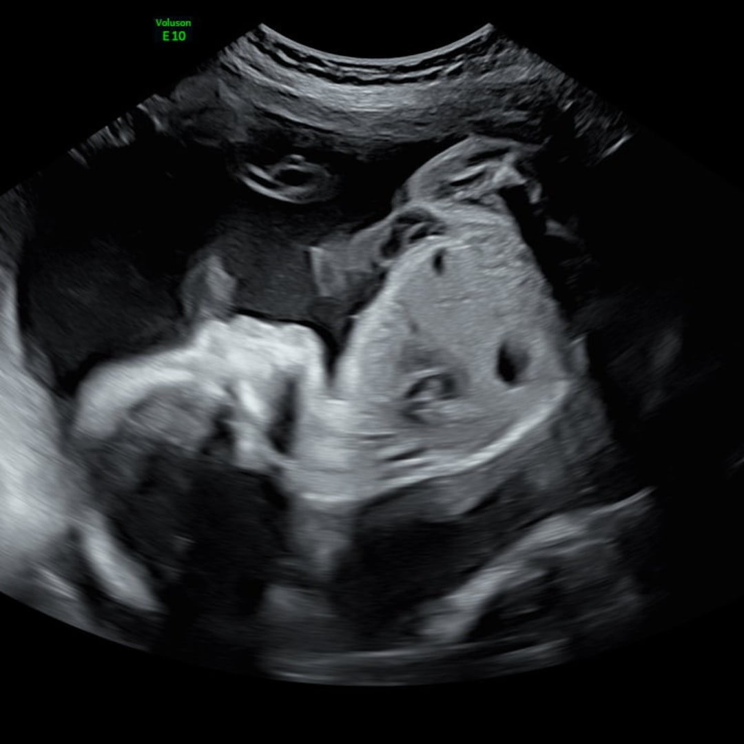 Photo shared by Dominika for their Babylist baby registry.