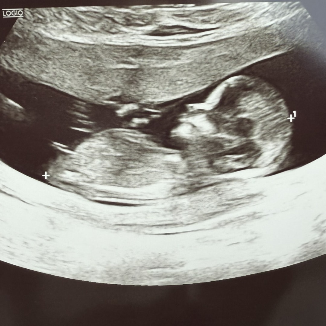 Photo shared by Ashley for their Babylist baby registry.