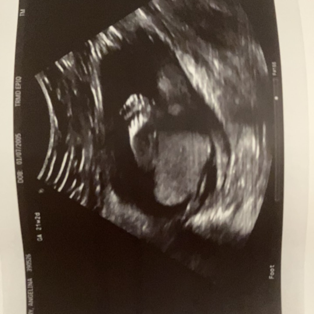 Photo shared by Angel for their Babylist baby registry.
