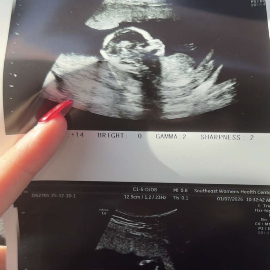 Photo shared by Ashlynn for their Babylist baby registry.