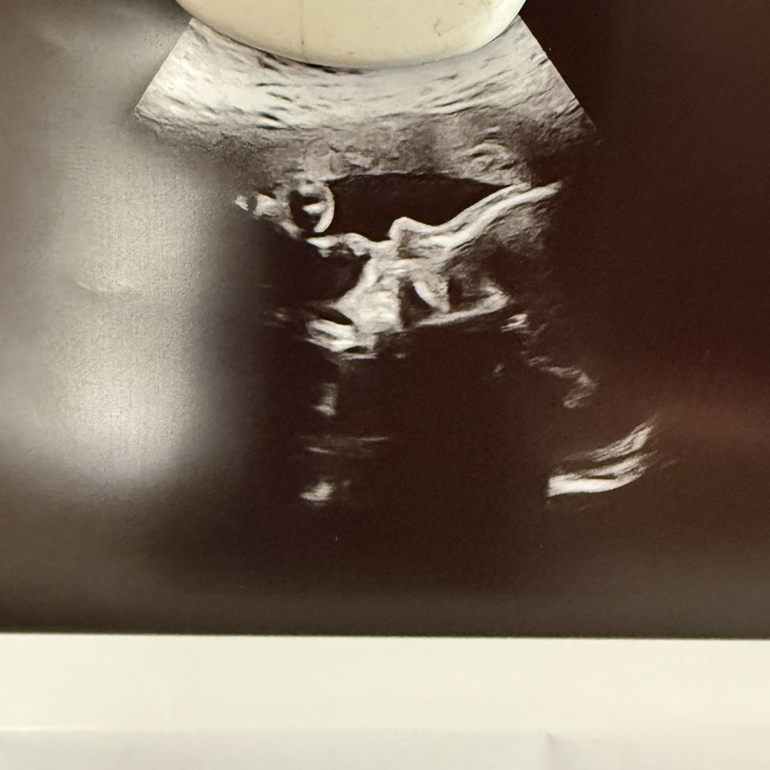 Photo shared by Christianna for their Babylist baby registry.