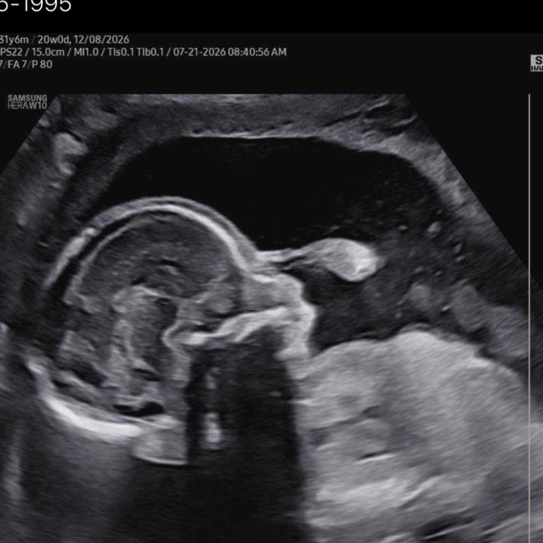 Photo shared by Katie & Zack for their Babylist baby registry.