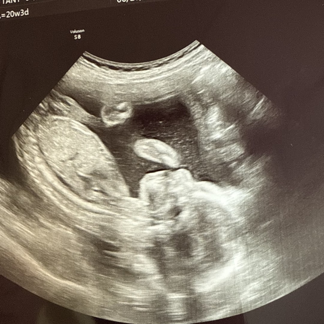Photo shared by Brittany for their Babylist baby registry.