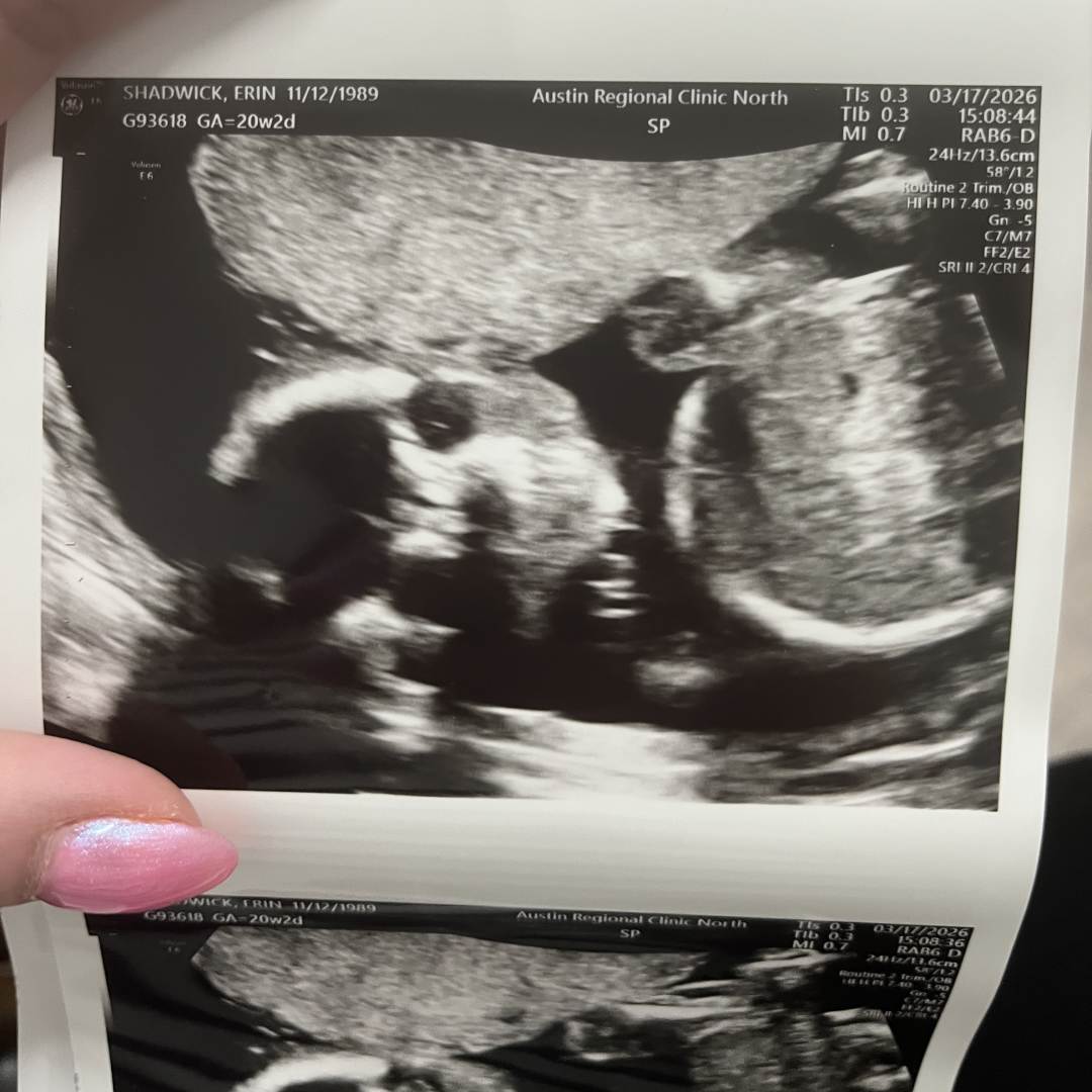 Photo shared by Erin for their Babylist baby registry.