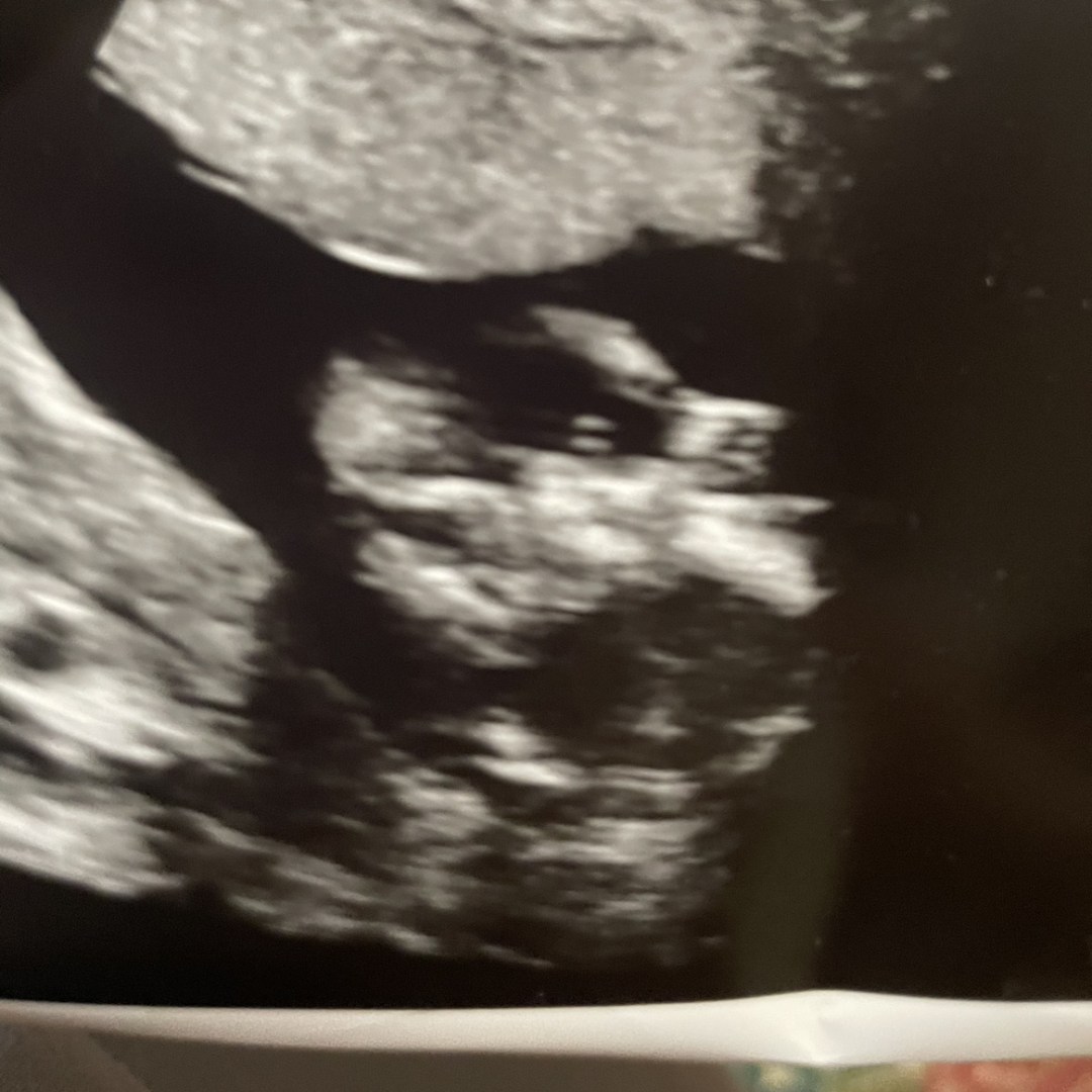 Photo shared by Candi for their Babylist baby registry.