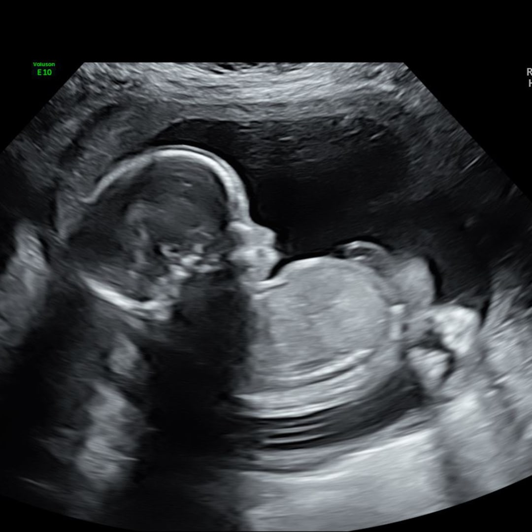 Photo shared by Lydia for their Babylist baby registry.