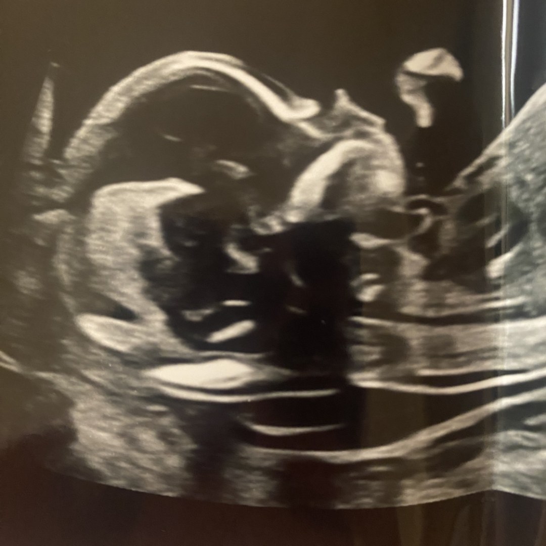 Photo shared by Sarah for their Babylist baby registry.