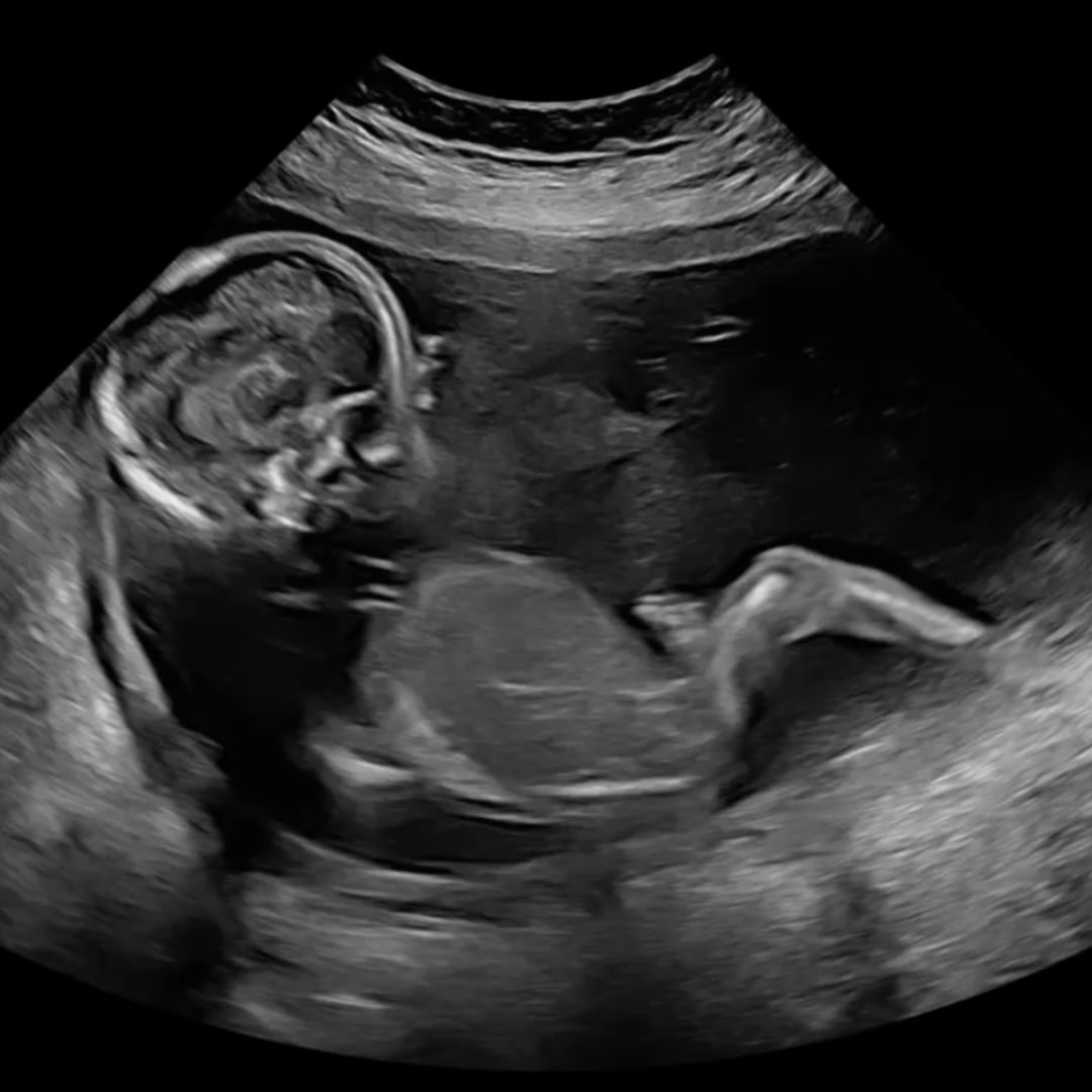 Photo shared by Alejandra for their Babylist baby registry.