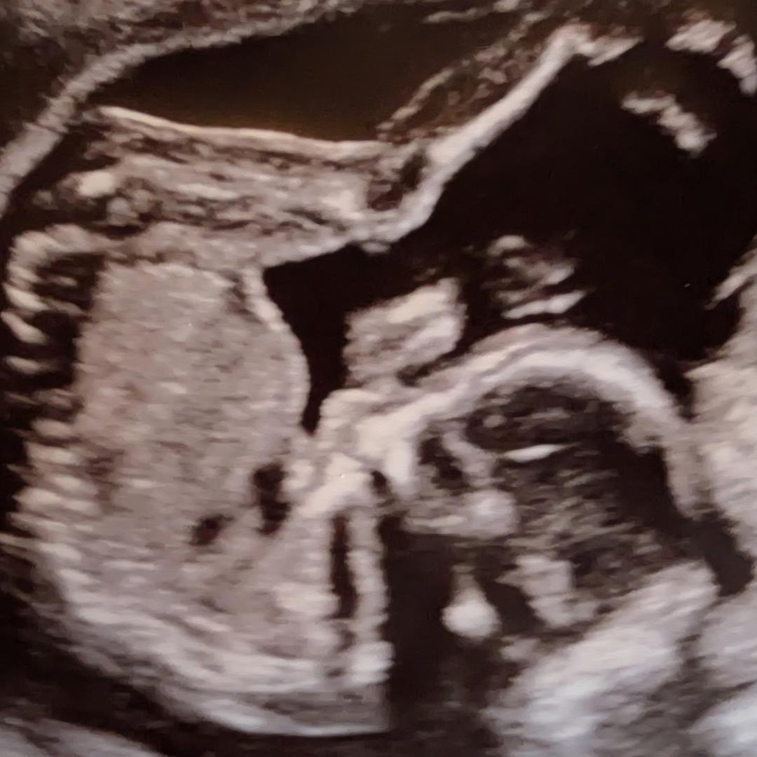 Photo shared by Jesse for their Babylist baby registry.