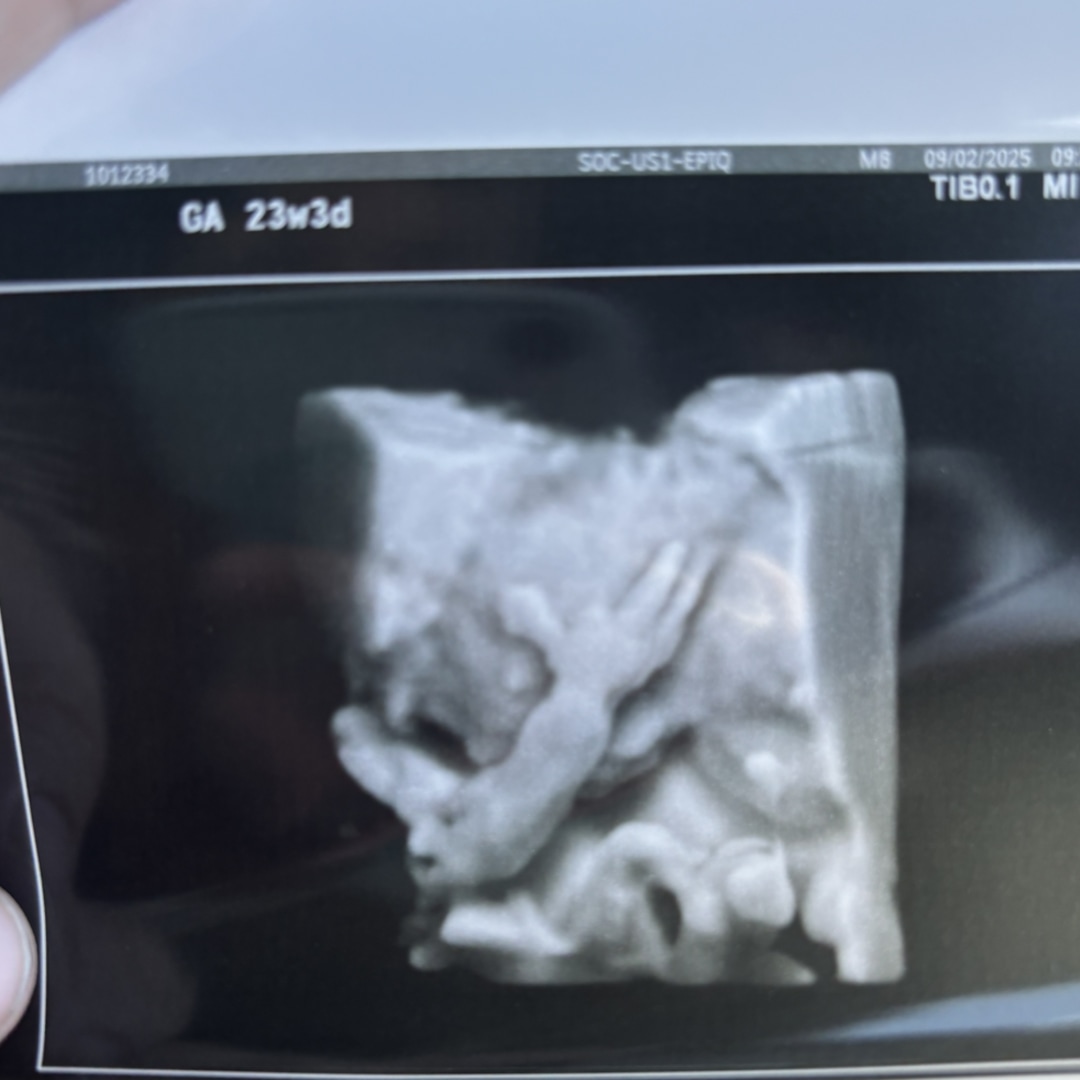 Photo shared by Tessa for their Babylist baby registry.