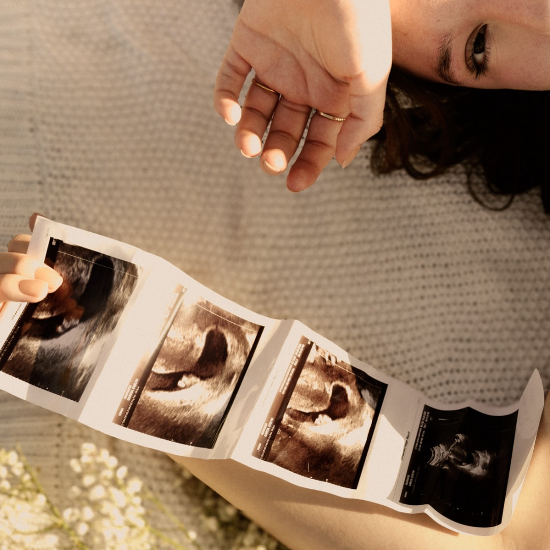 Photo shared by Evelyn for their Babylist baby registry.