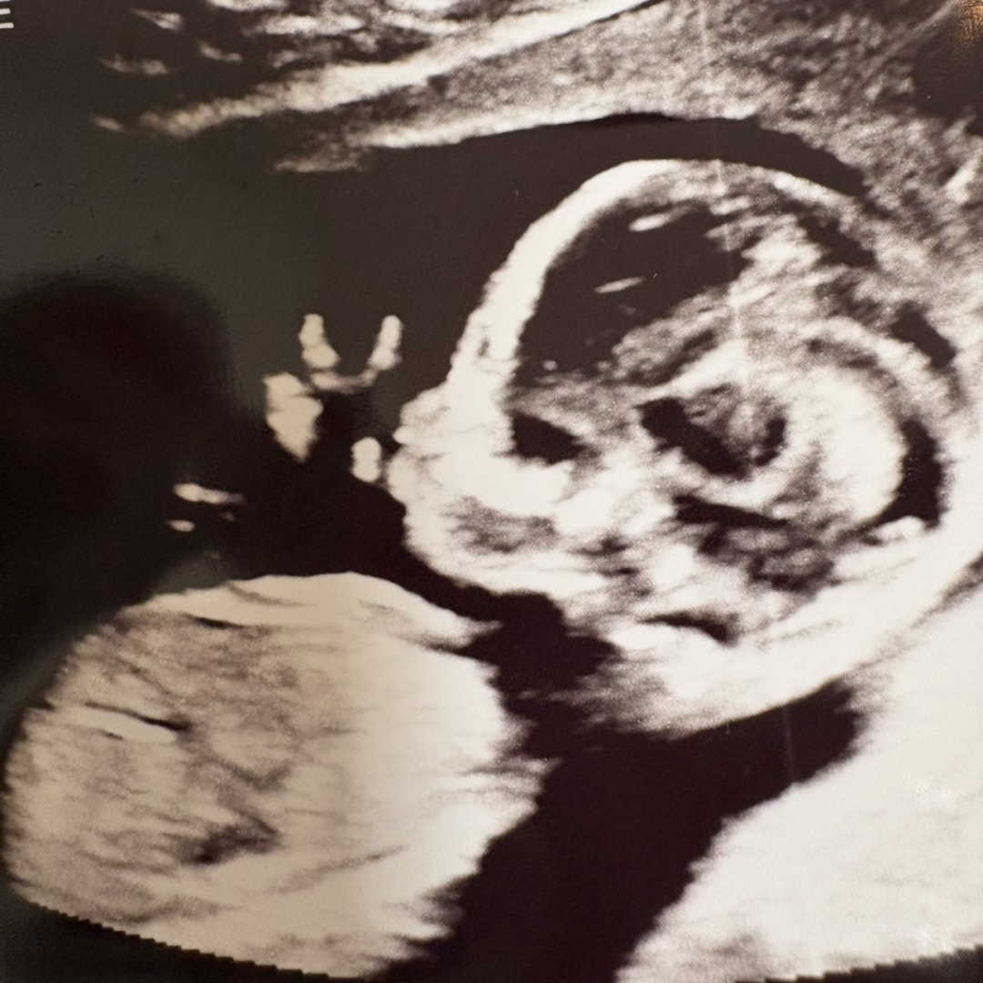 Photo shared by Alli for their Babylist baby registry.