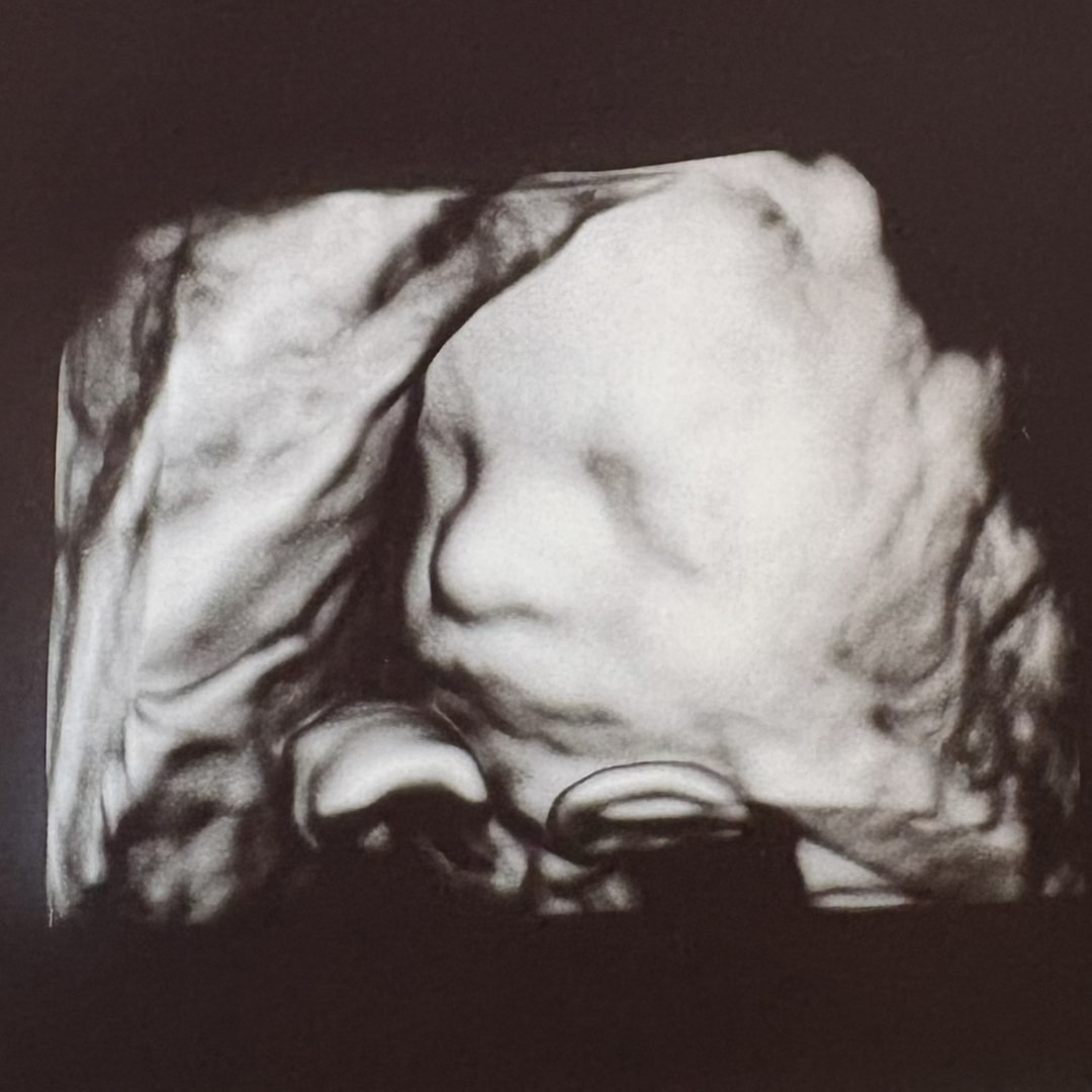 Photo shared by Megan for their Babylist baby registry.