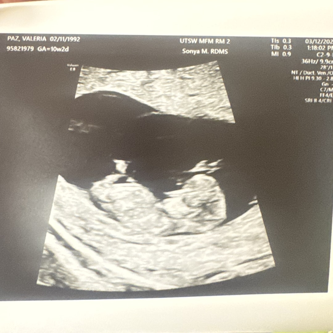 Photo shared by Valeria for their Babylist baby registry.