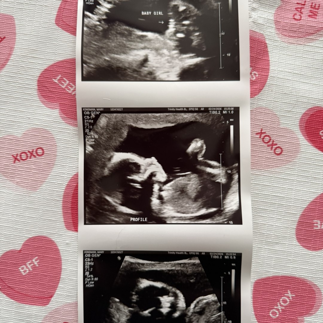 Photo shared by Mary for their Babylist baby registry.