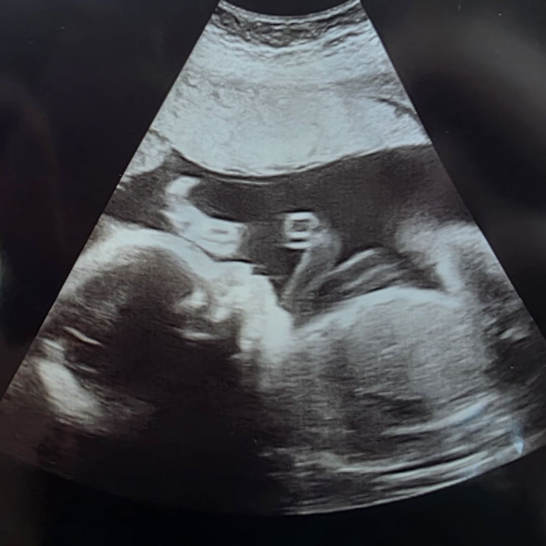 Photo shared by Margaret for their Babylist baby registry.