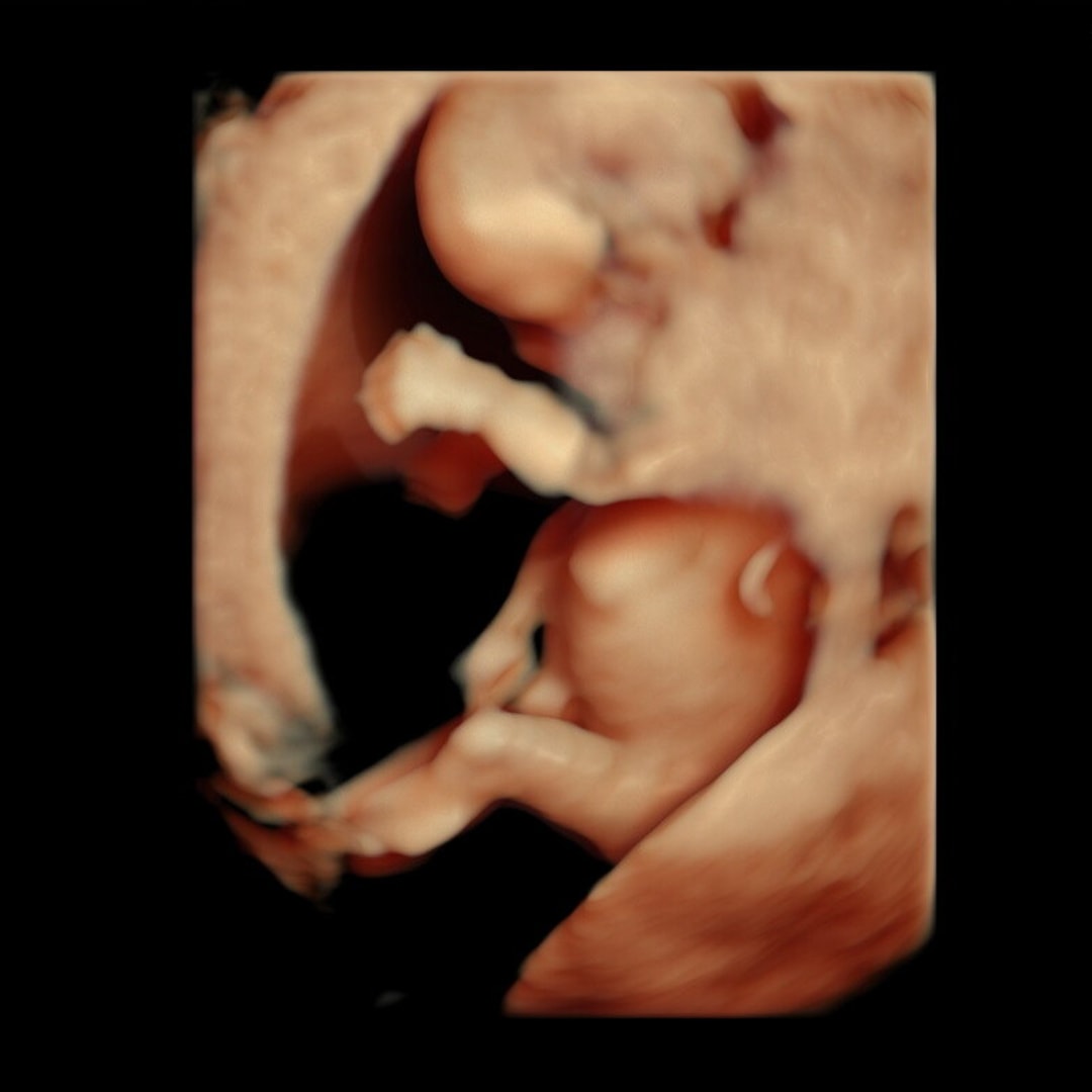 Photo shared by Reyn for their Babylist baby registry.