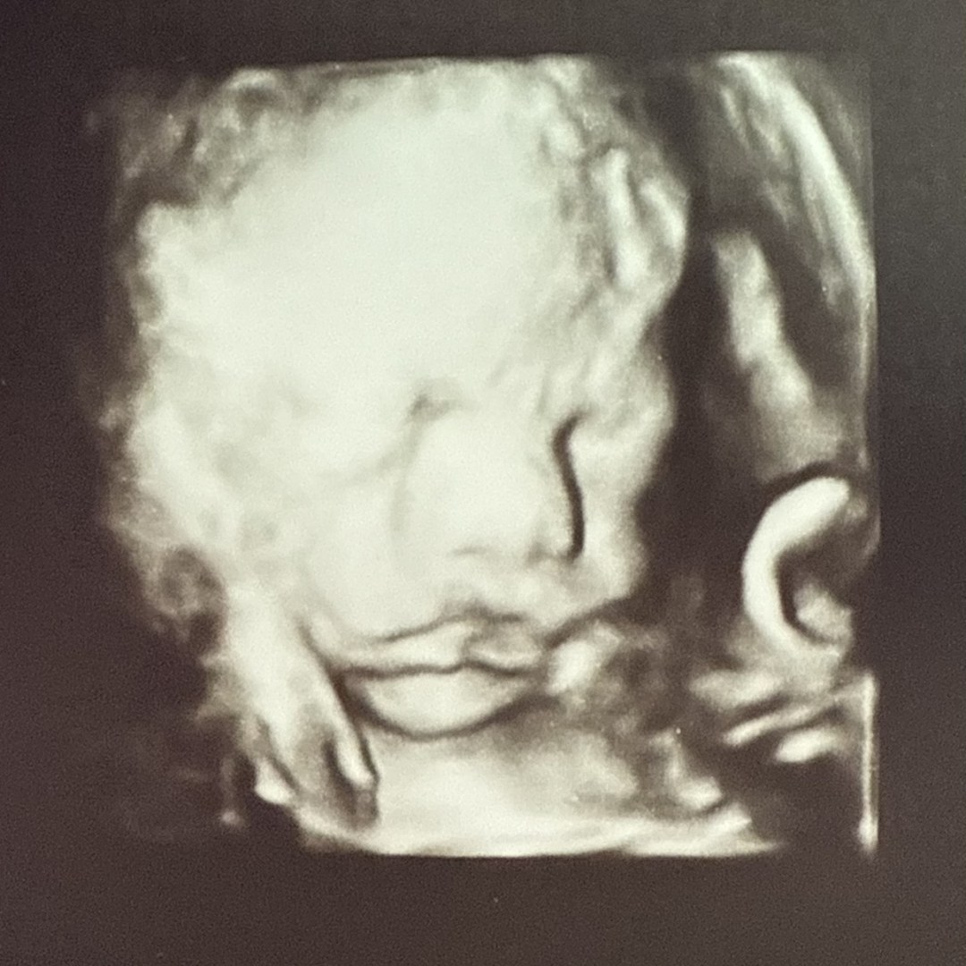 Photo shared by Ricky for their Babylist baby registry.