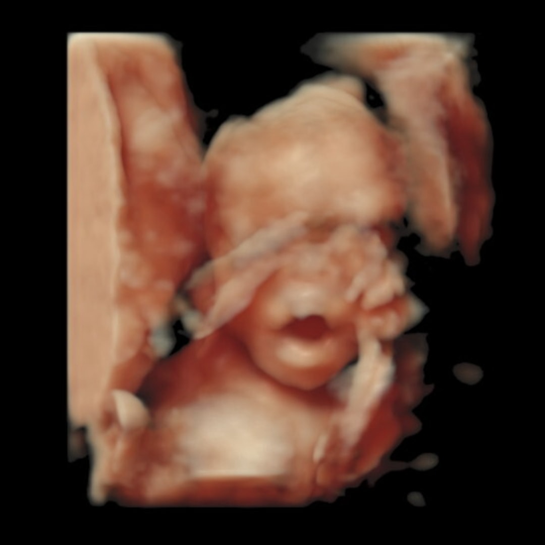 Photo shared by Jazmine for their Babylist baby registry.