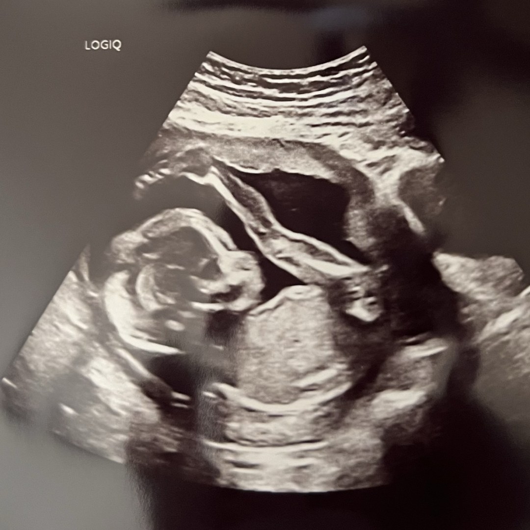 Photo shared by Pang for their Babylist baby registry.