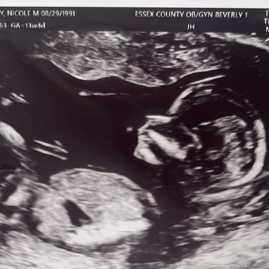 Photo shared by Nicole for their Babylist baby registry.