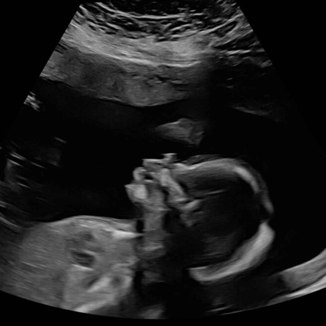 Photo shared by Courtney for their Babylist baby registry.