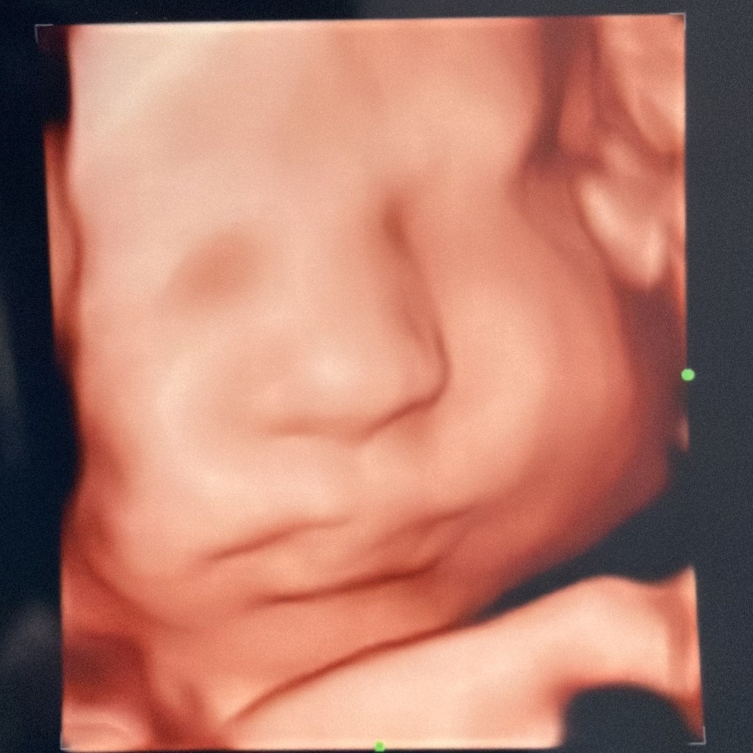 Photo shared by Stephanie for their Babylist baby registry.