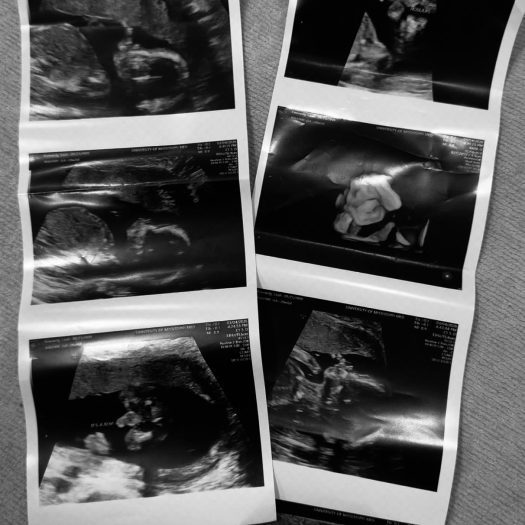 Photo shared by Leah for their Babylist baby registry.