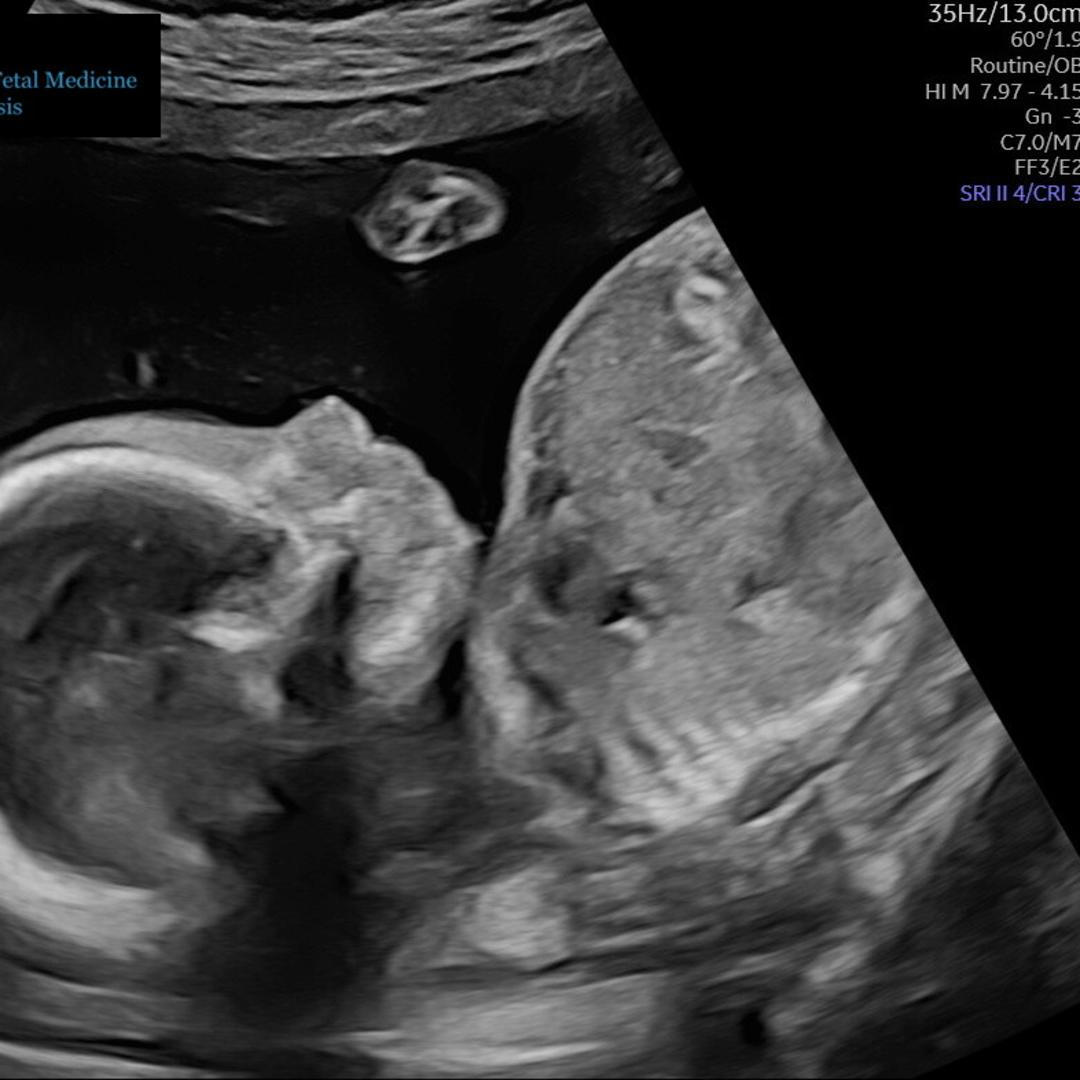 Photo shared by Megan for their Babylist baby registry.