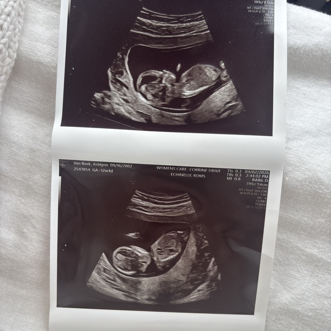 Photo shared by Ashlynn for their Babylist baby registry.