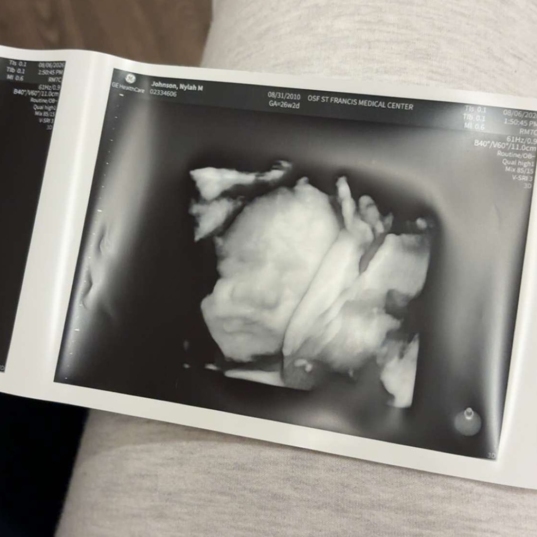 Photo shared by Nylah for their Babylist baby registry.