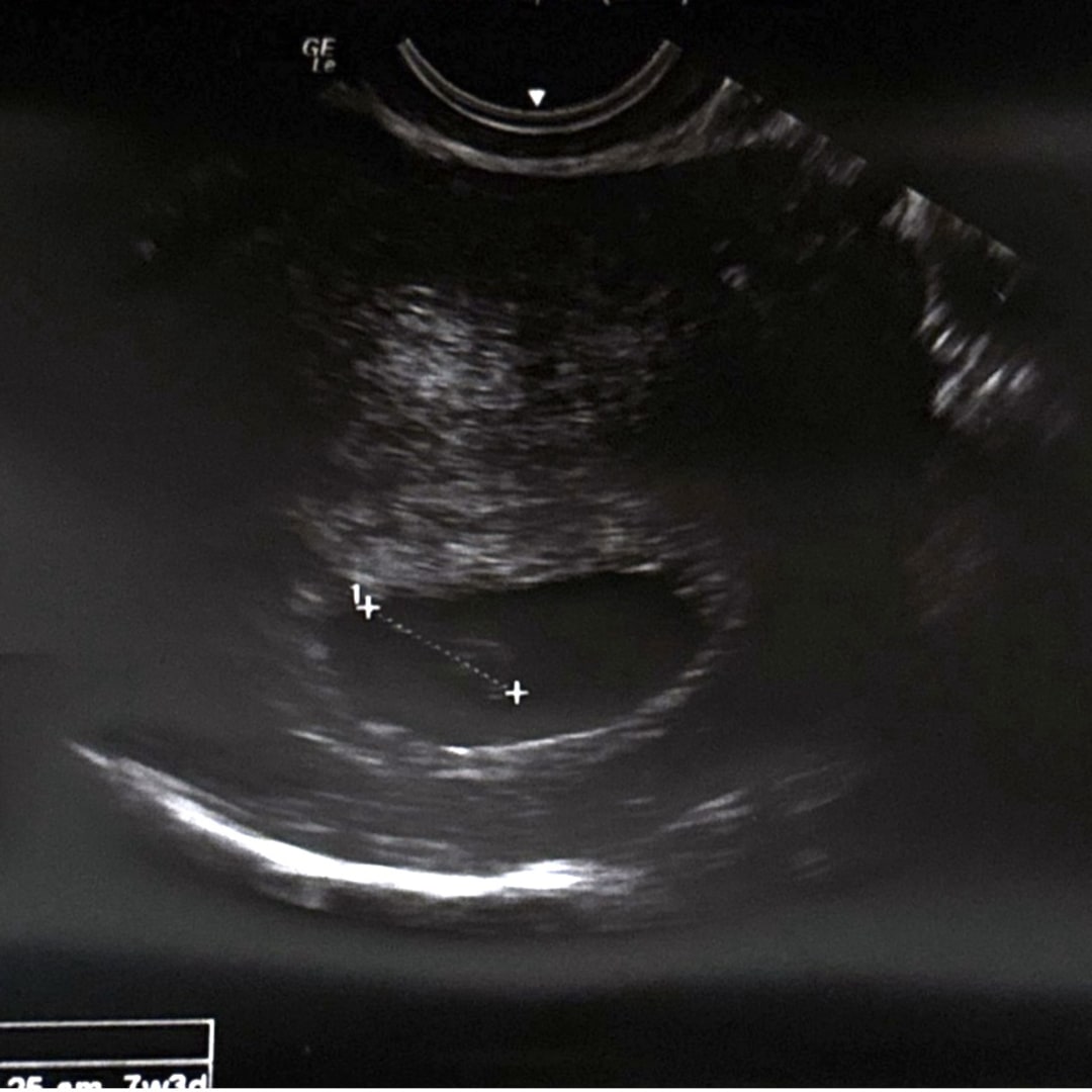 Photo shared by Chloe for their Babylist baby registry.