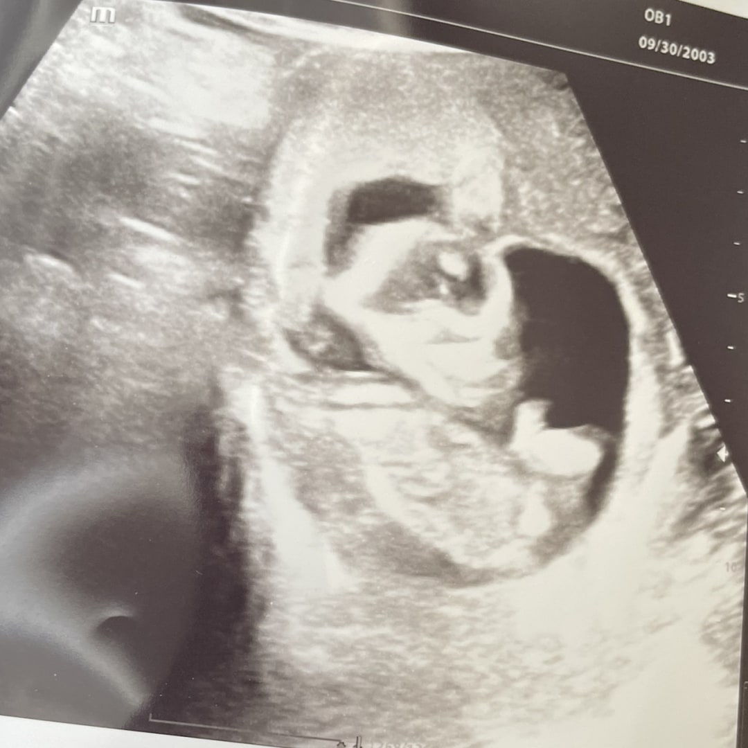 Photo shared by Zephariah for their Babylist baby registry.