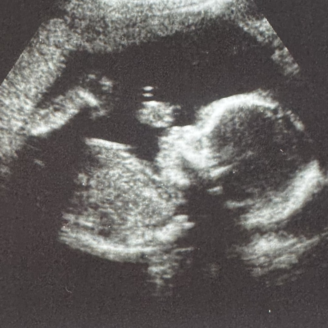 Photo shared by Litzy for their Babylist baby registry.