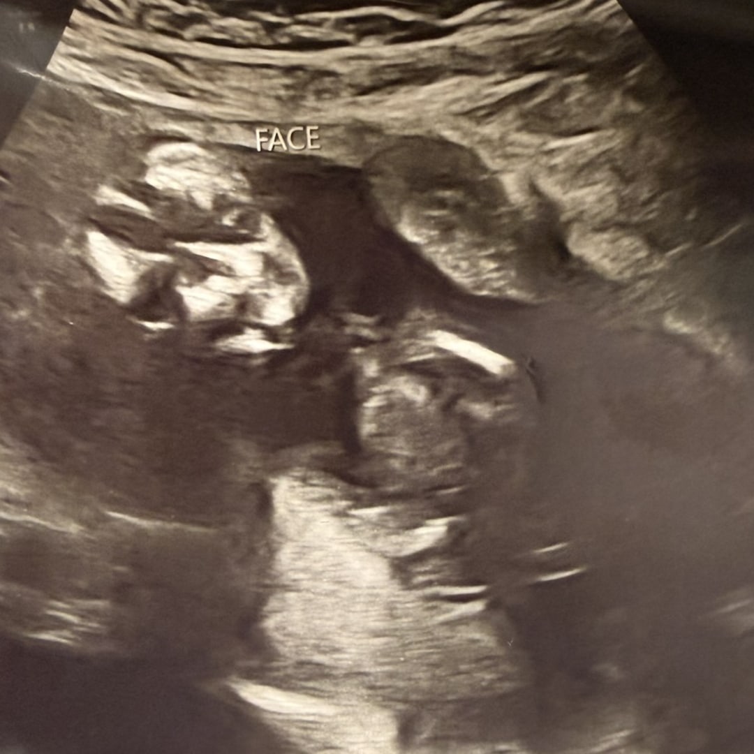 Photo shared by Naomi for their Babylist baby registry.