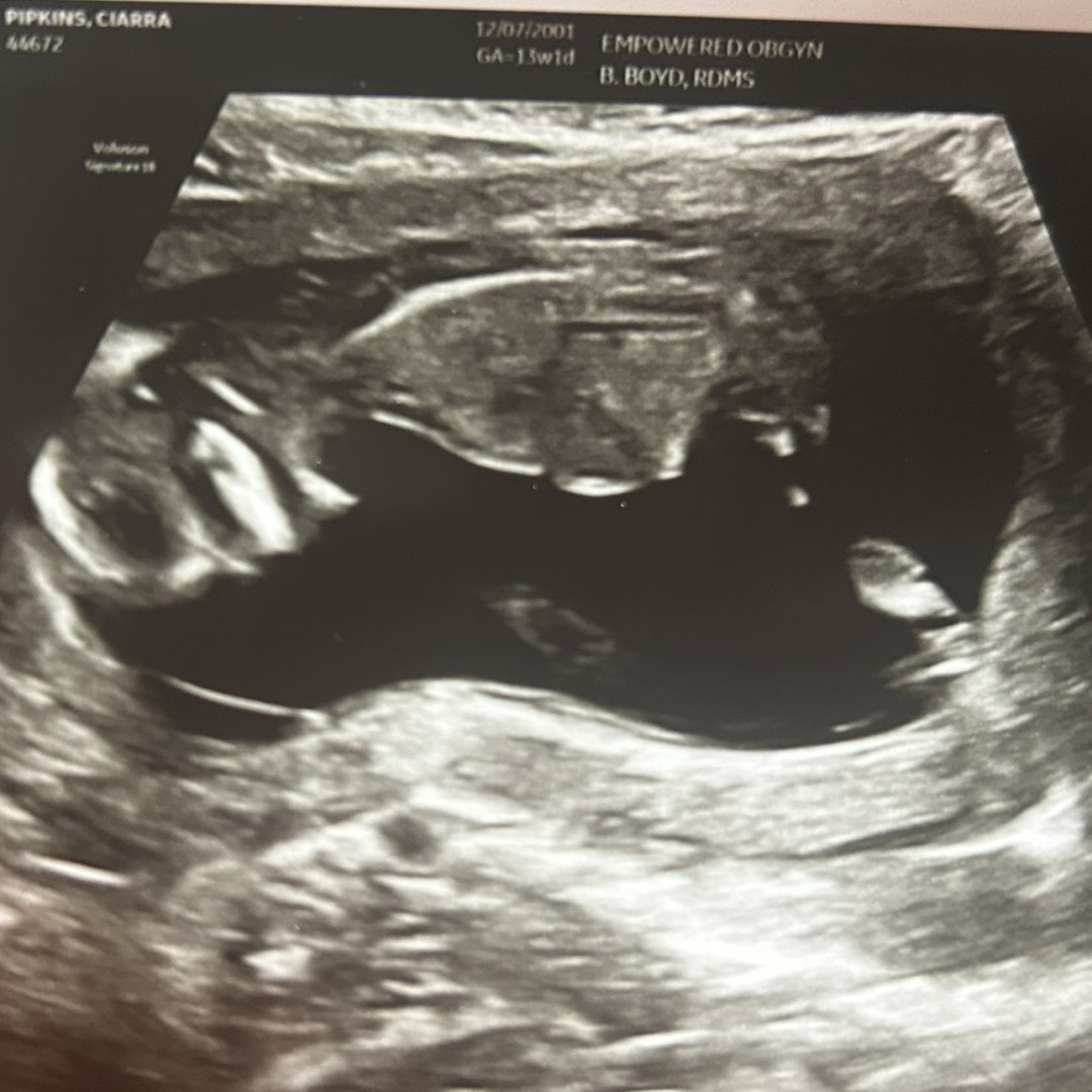 Photo shared by Jason for their Babylist baby registry.