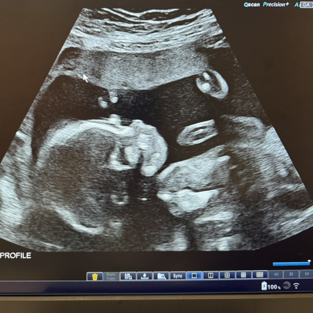 Photo shared by Nora for their Babylist baby registry.