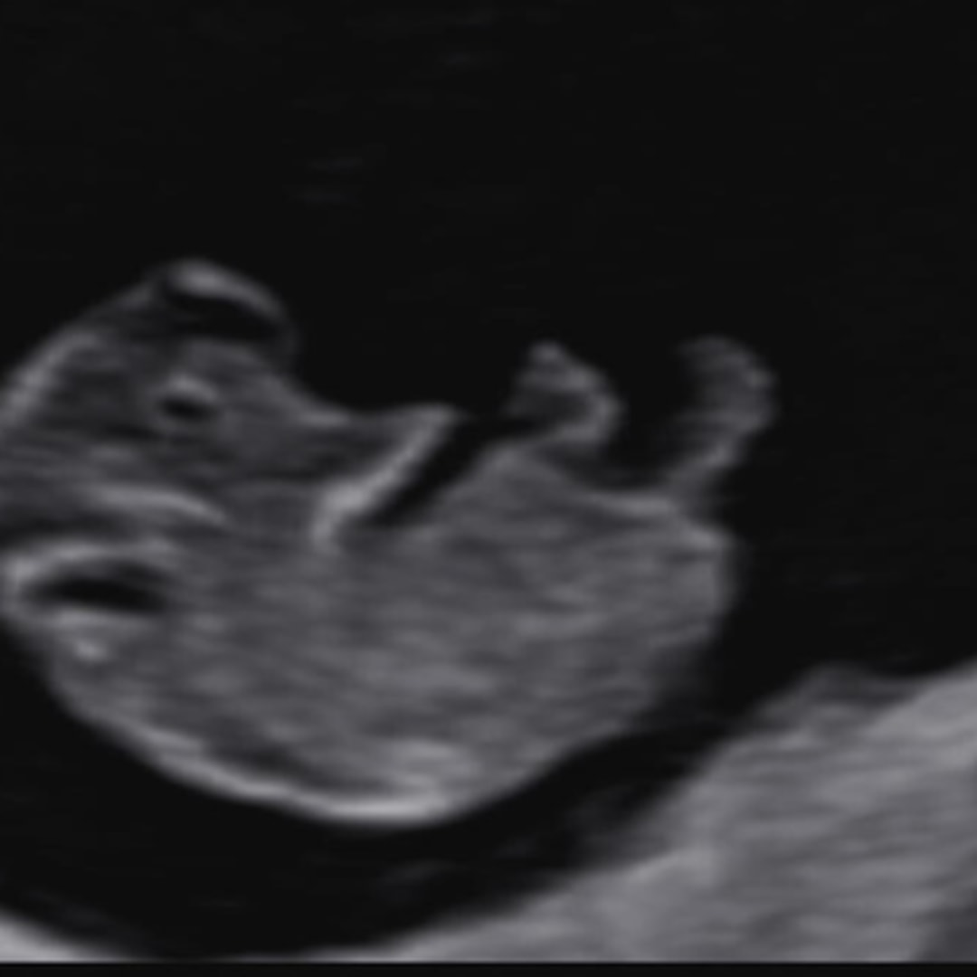 Photo shared by Carissa for their Babylist baby registry.