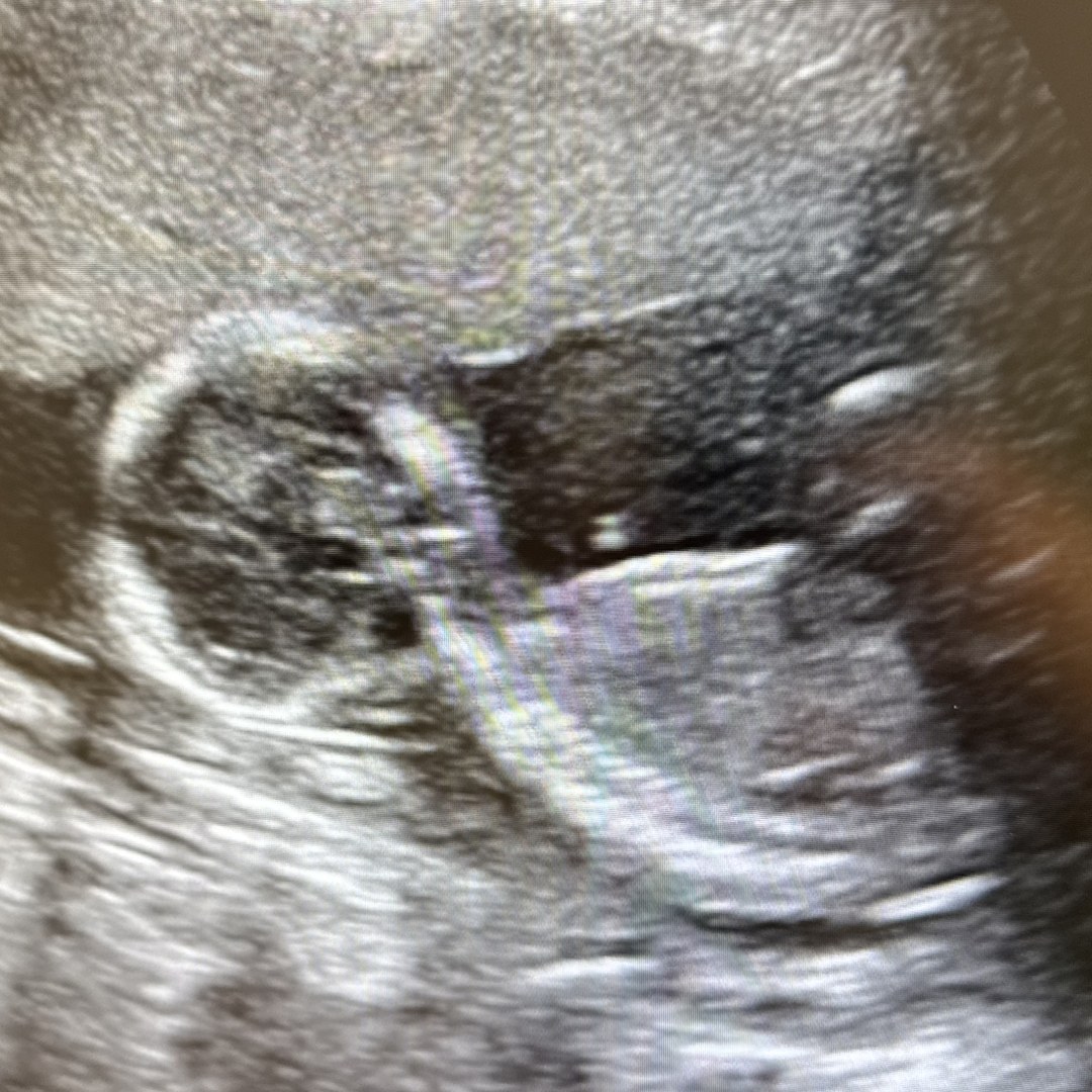 Photo shared by Rachel for their Babylist baby registry.