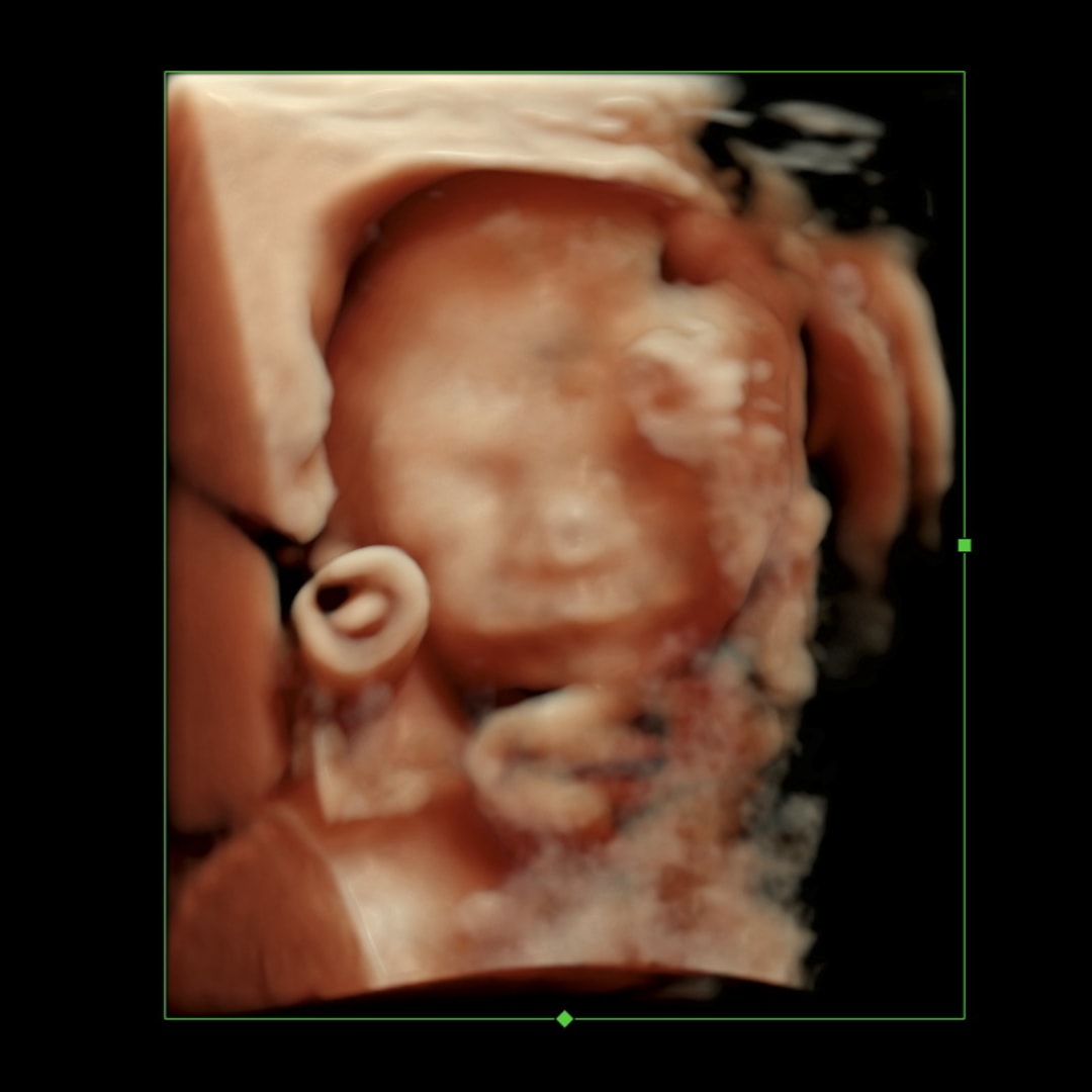 Photo shared by Avery for their Babylist baby registry.