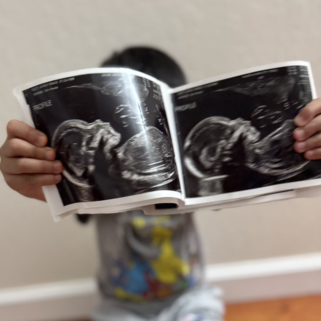 Photo shared by Lovely Grace for their Babylist baby registry.