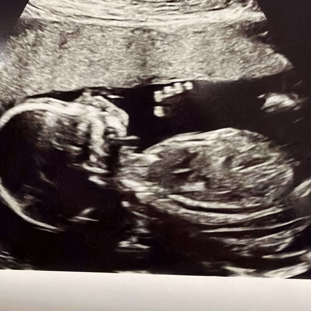 Photo shared by Michelle for their Babylist baby registry.