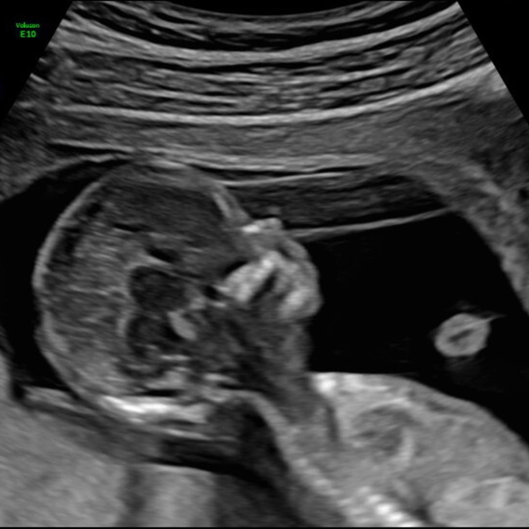 Photo shared by Daniella for their Babylist baby registry.