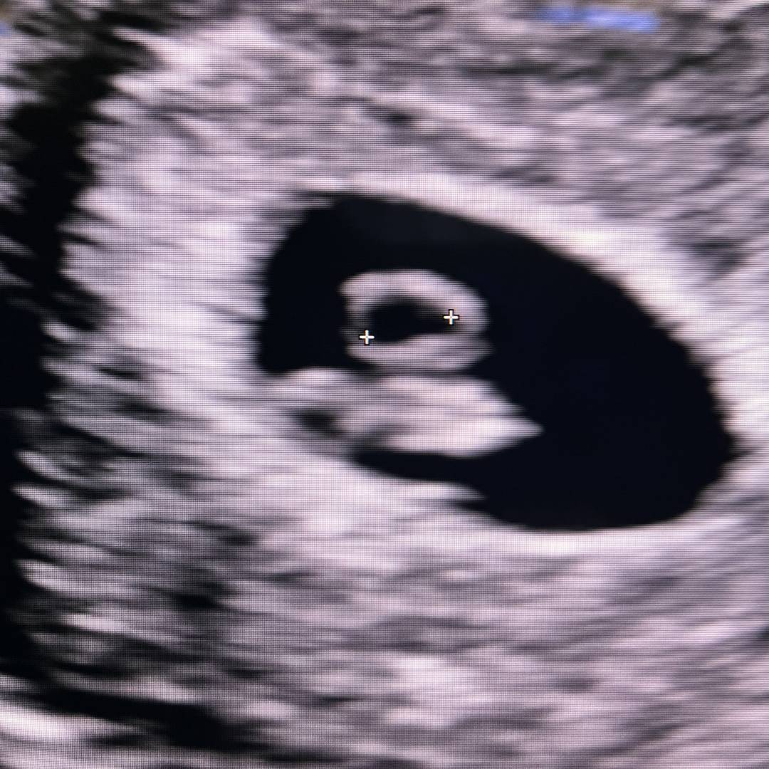 Photo shared by Selena for their Babylist baby registry.